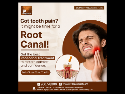 Root canal treatment in Indirapuram